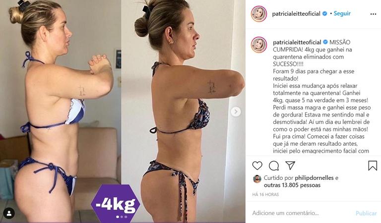 Ex-BBB Patrícia Leitte perde 4 quilos em 9 dias e mostra antes e depois
