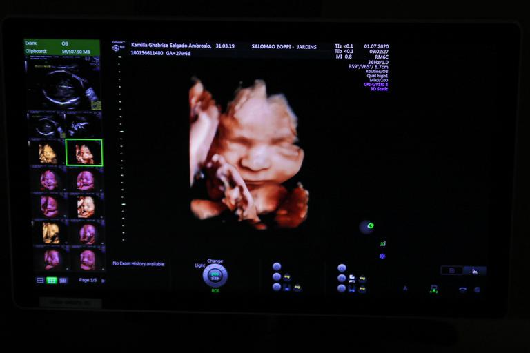 Kamilla Salgado e Elieser Ambrósio mostram rostinho do filho em ultrassom 3D