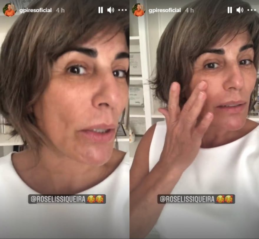 Gloria Pires mostra evolução de procedimento estético no rosto