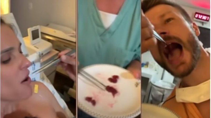 Fernanda Lima e Rodrigo Hilbert comeram a placenta após o nascimento da filha caçula