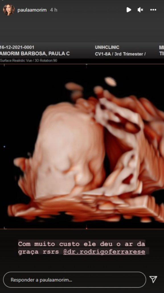 Paula Amorim mostra rostinho do filho em ultrassom