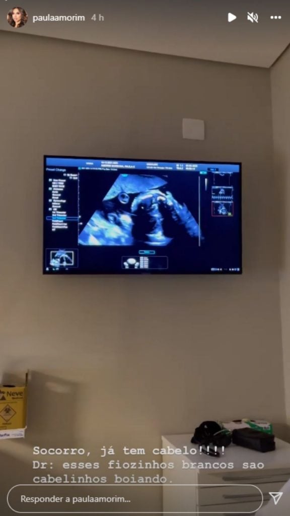 Paula Amorim mostra rostinho do filho em ultrassom