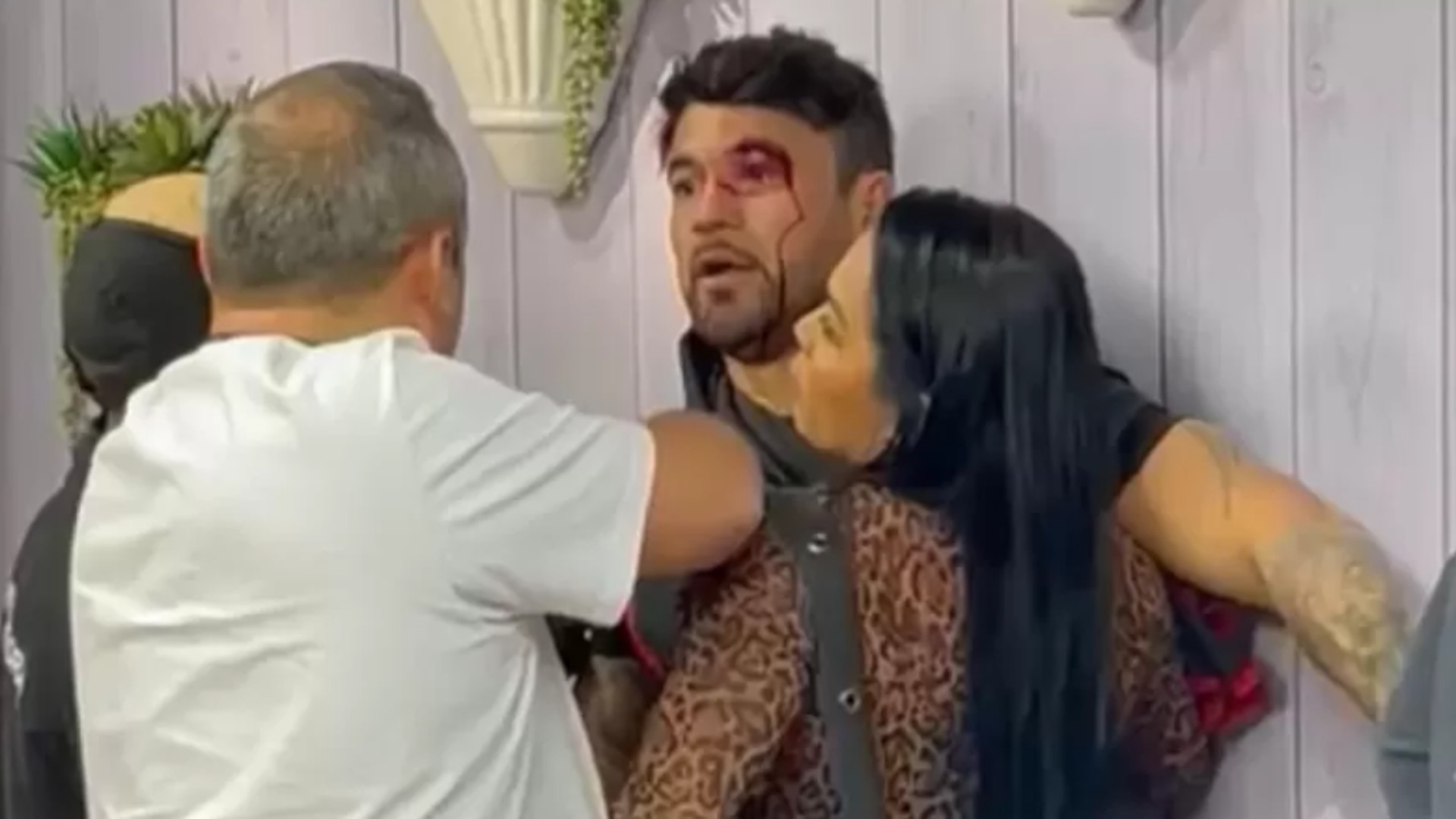 Hadson aparece machucado após briga com Vini em gravação da Record