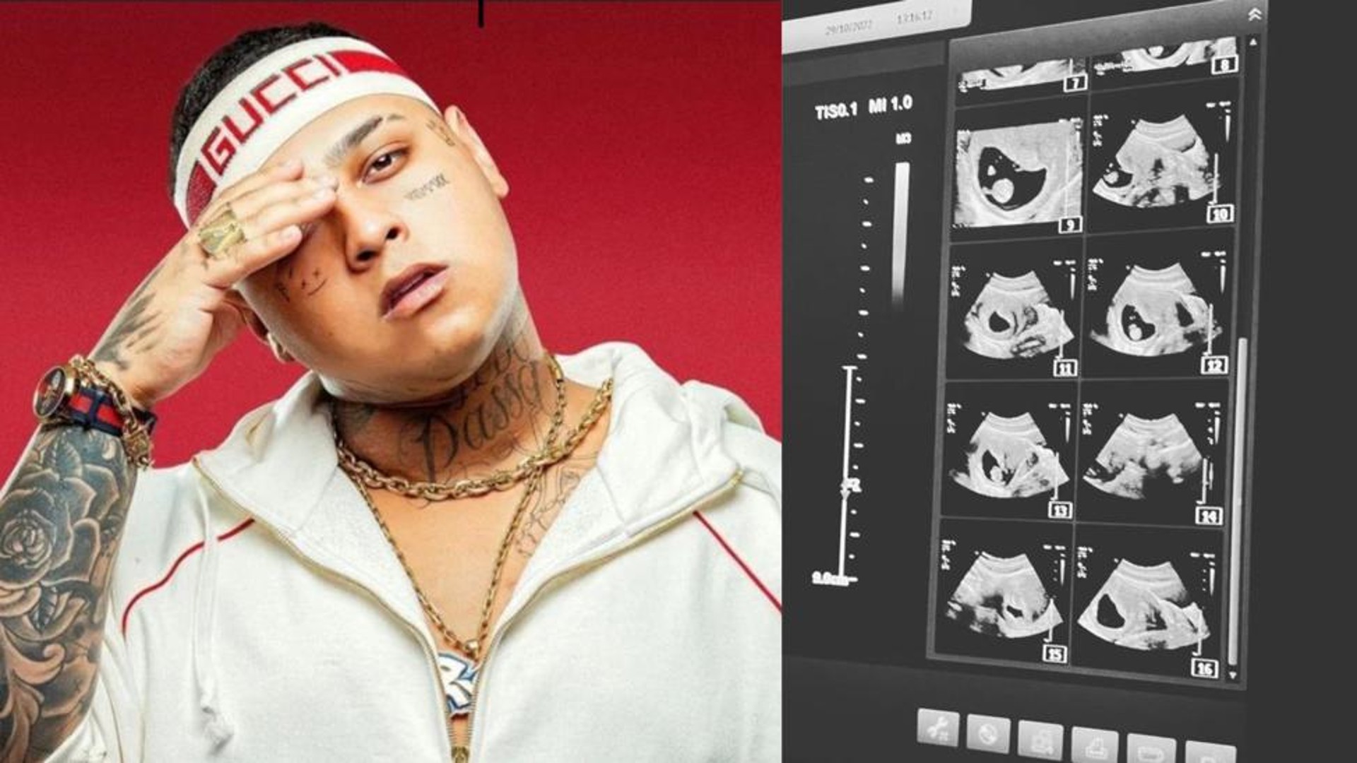 MC Ryan. Reprodução/Instagram
