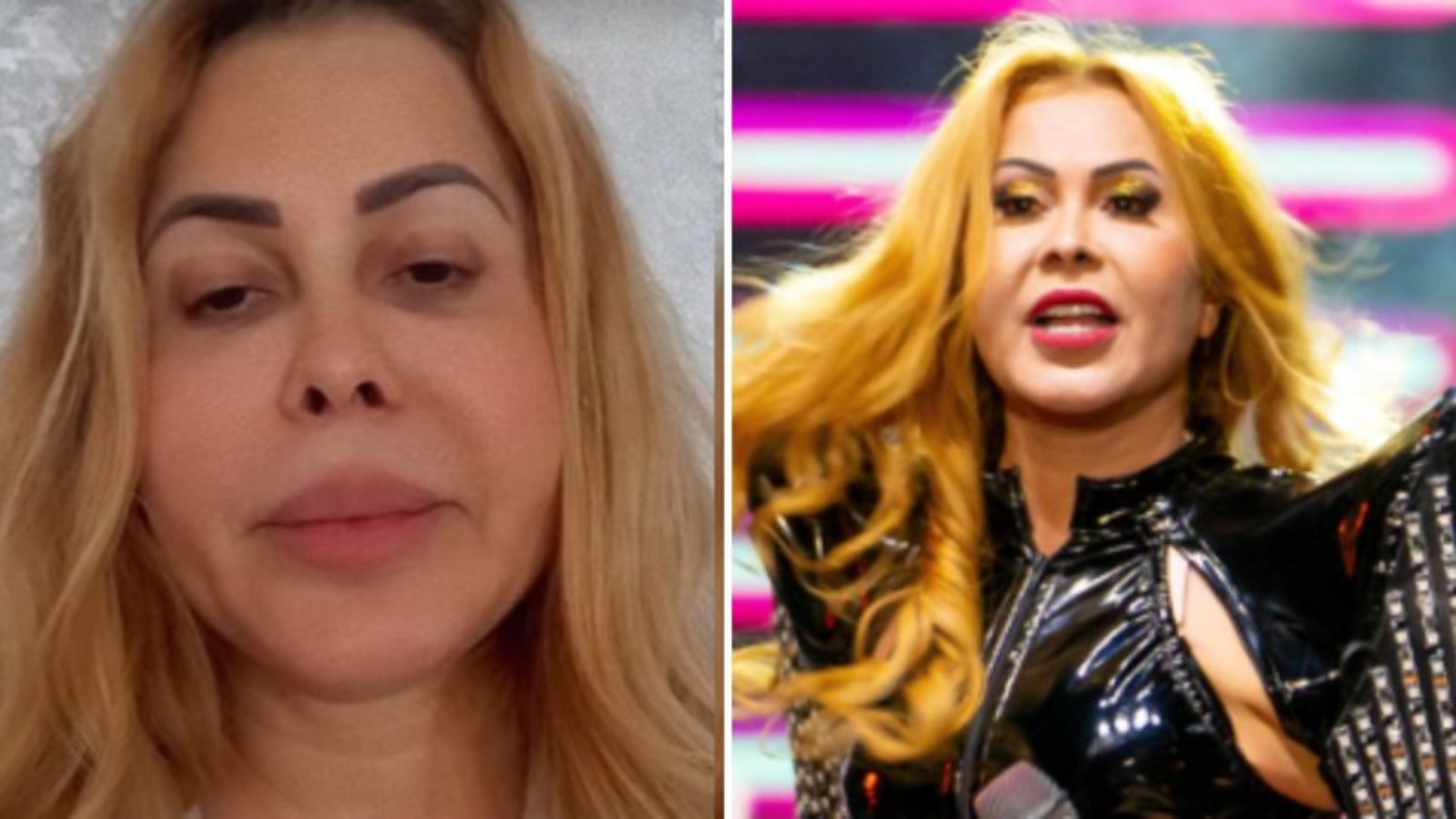 Na esquerda, Joelma doente. Na direita, a cantora em suas apresentações de rotina. Foto: Reprodução/Instagram