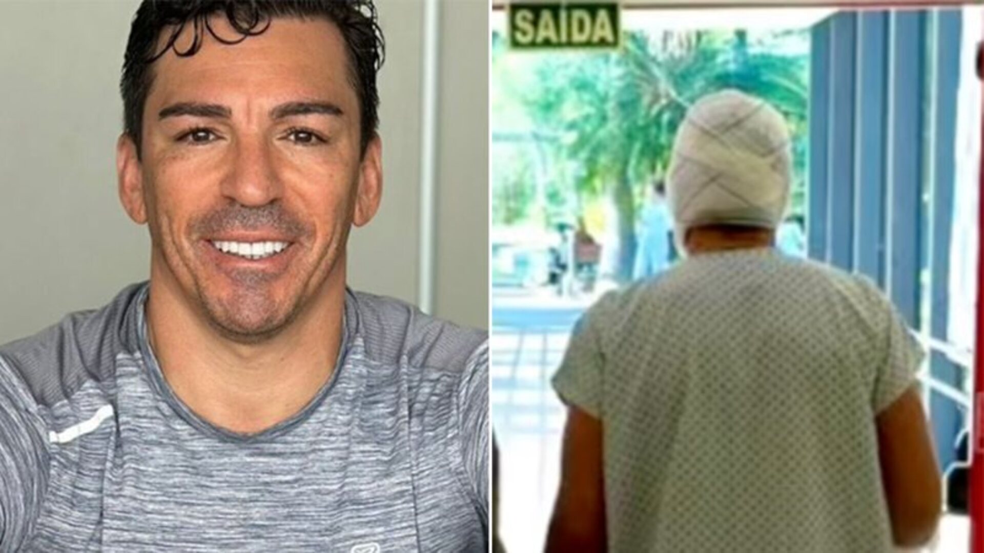 Lúcio sofreu queimaduras no corpo - Foto: Reprodução/Instagram